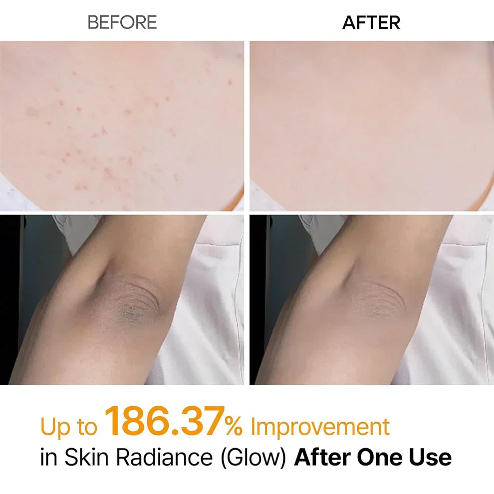 Body Peel Shot Spray – Smooth Skin Care