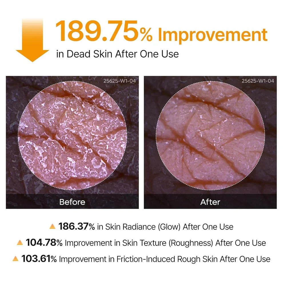 Body Peel Shot Spray – Smooth Skin Care