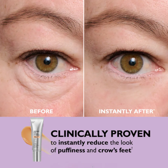 Instant Eye Tightener – Smoother Eye Area