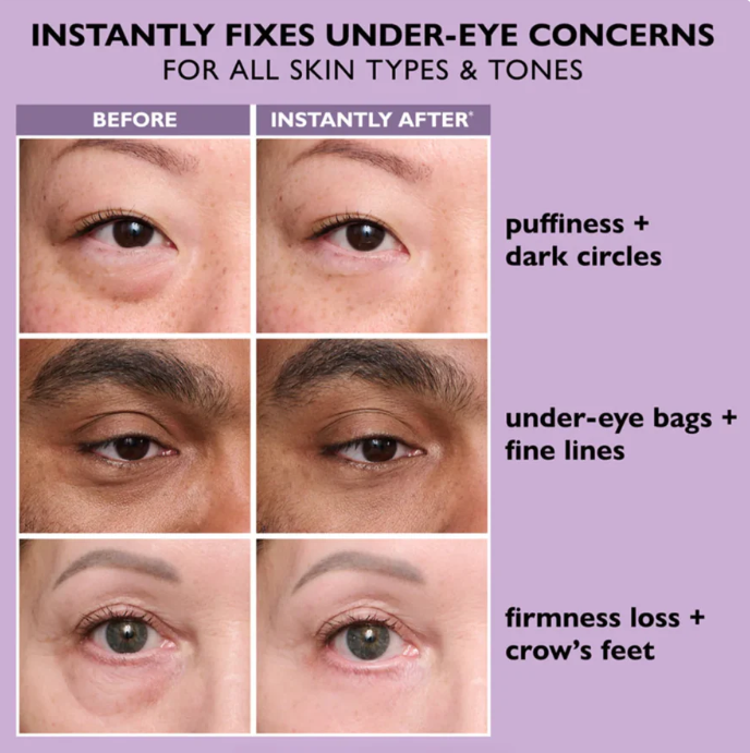 Instant Eye Tightener – Smoother Eye Area